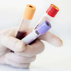 CITOQUIMICO DE LIQUIDO BIOLOGICO