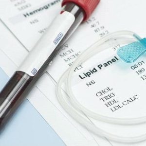 Perfil de lipidos