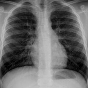RX COLUMNA DORSAL