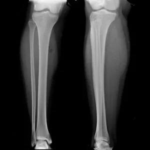 Radiografia pierna ap lateral