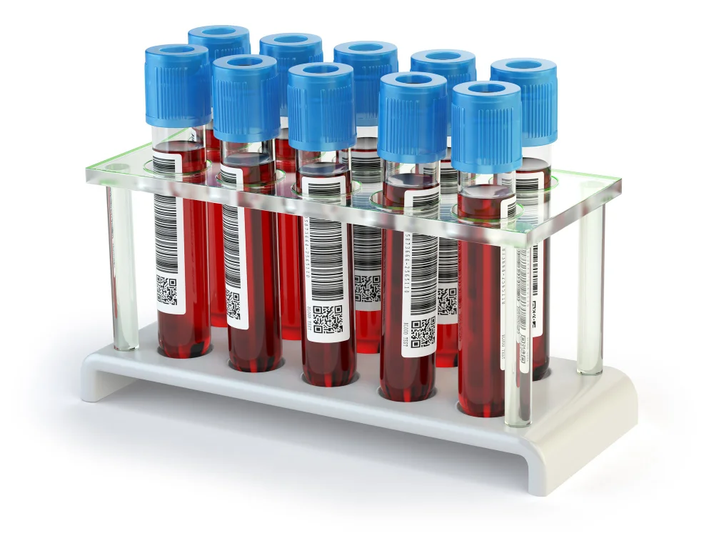 Muestras clinicas